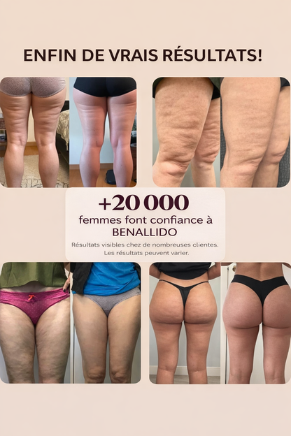 3D Anti-Cellulite Leggings