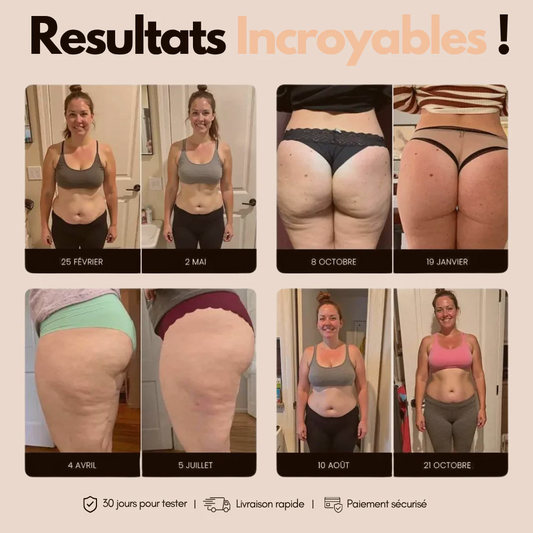 Leggings Anti Cellulite 3D